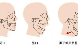下颌关节脱位复位视频,下颌关节脱位复位操作步骤详解